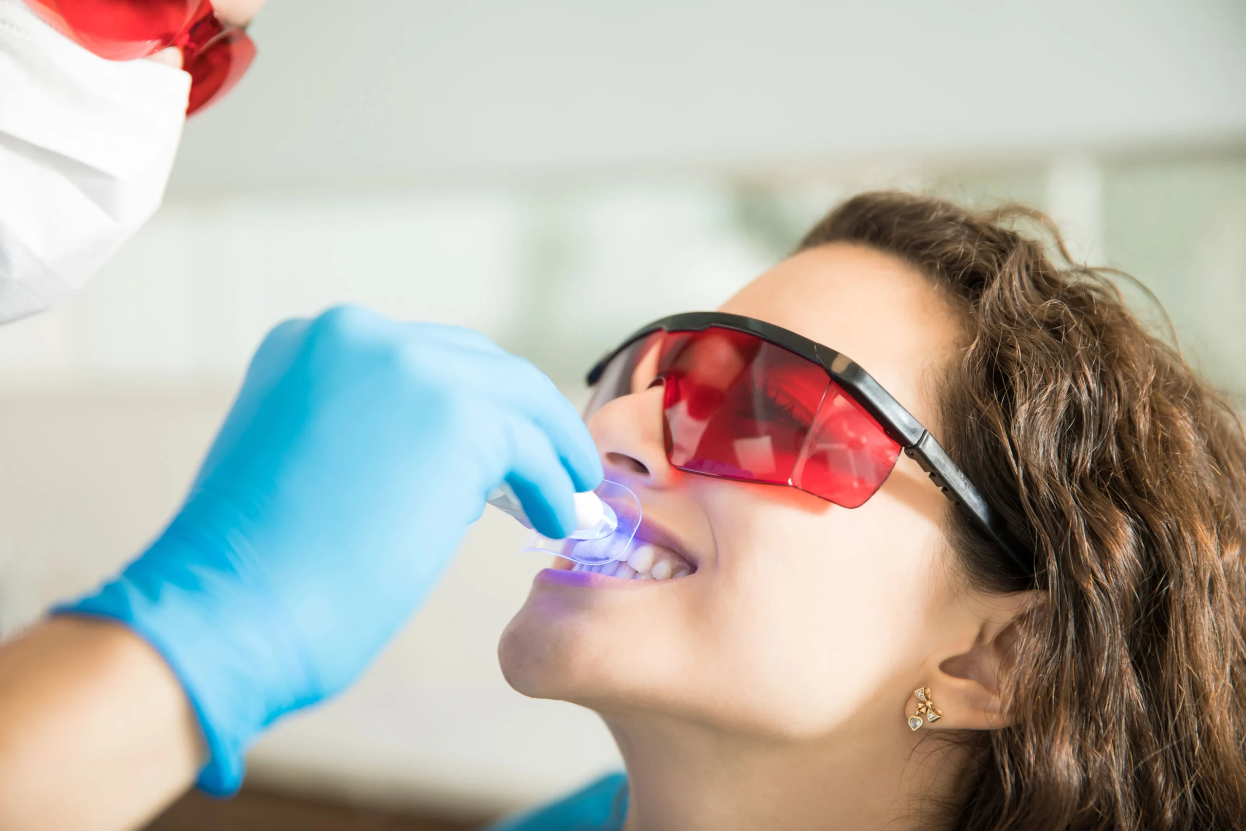 Lo que debes saber sobre el blanqueamiento dental