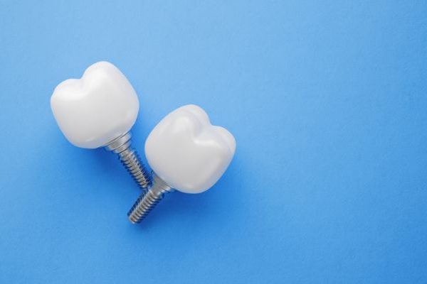 Implantes dentales en pacientes mayores: ¿son adecuados?