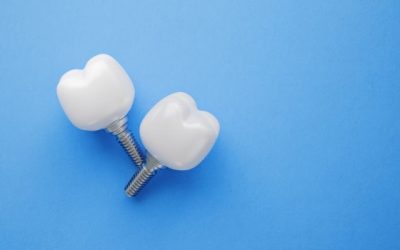 Implantes dentales en pacientes mayores: ¿son adecuados?